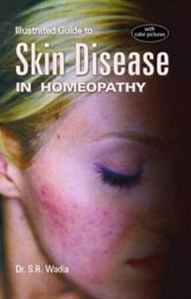 Illustrated Guide To Skin Diseases In Homeopathy With(16 Colored Illustrations)