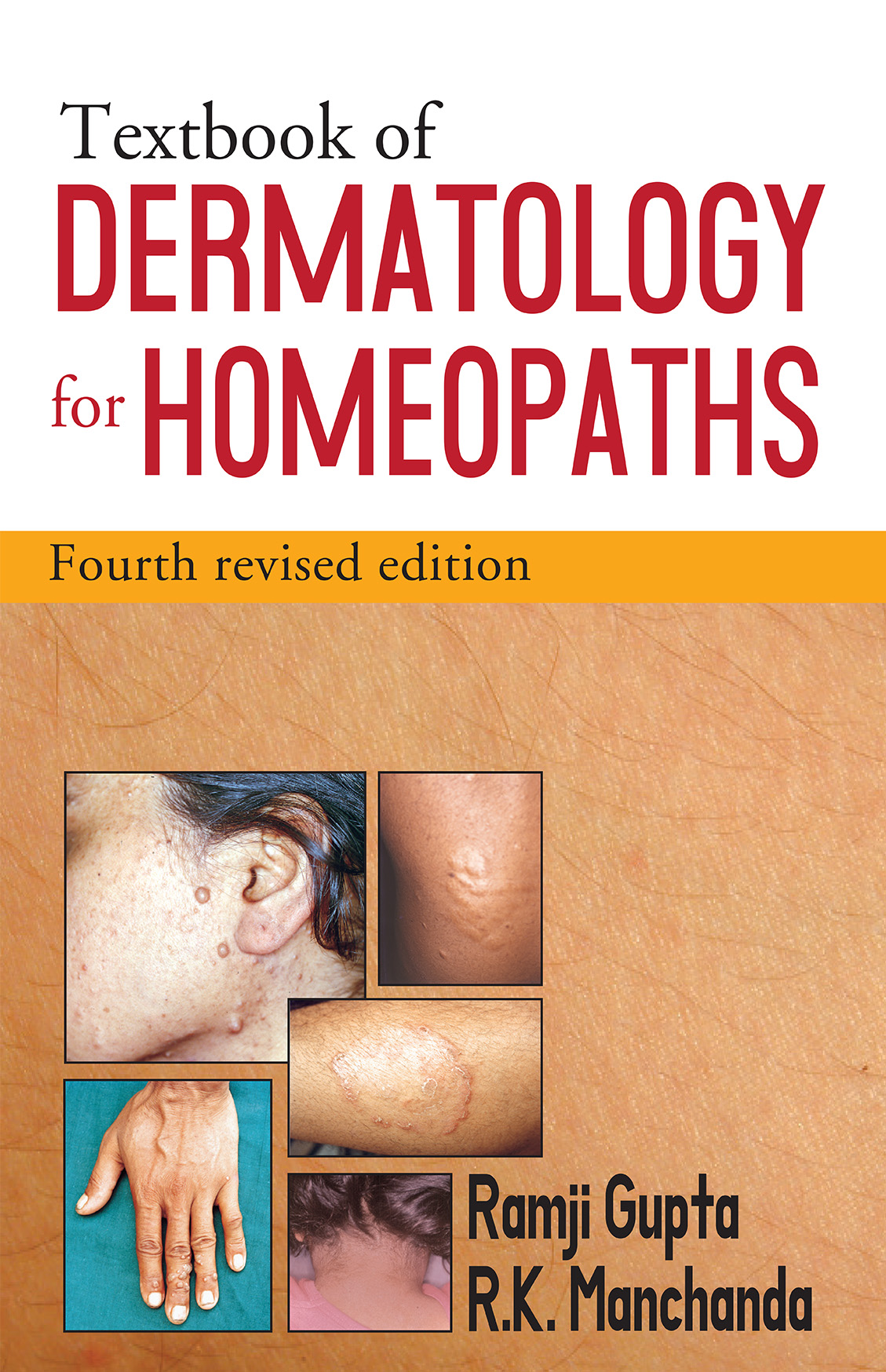 Textbook Of Dermatology For Homoeopaths